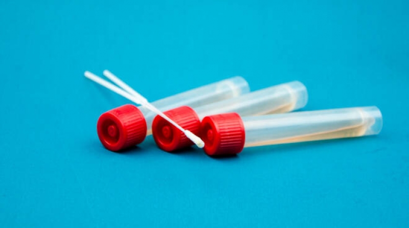 Chiarimenti urgenti sulle procedure di effettuazione dei test di positività al Coronavirus: Zinzi interroga De Luca